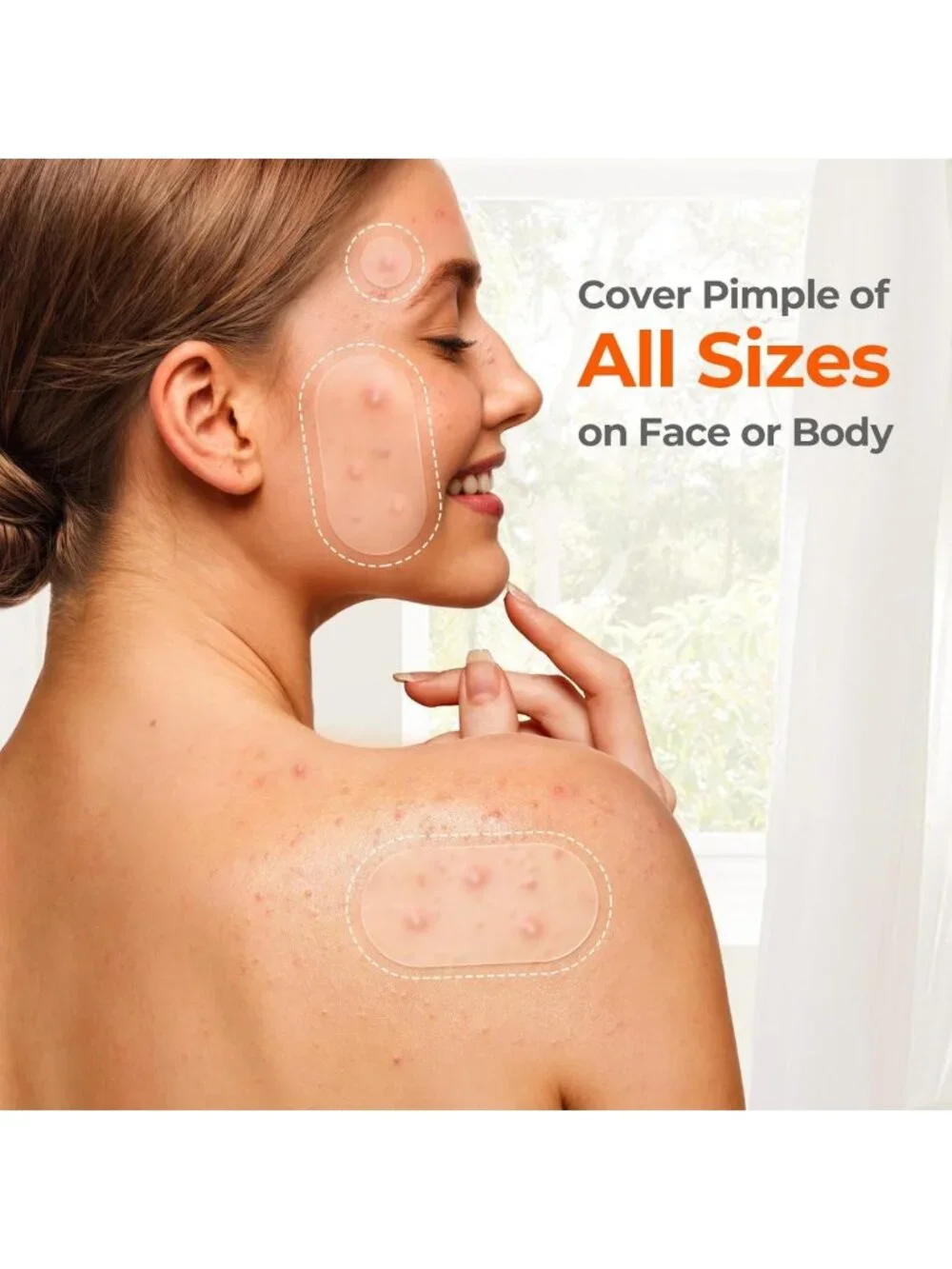 Hydrocolloid Acne Pimple Patches - 443 Count Face Cover for Clear Skin